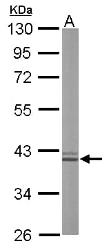 ARG1 / Arginase 1 Antibody (aa1-322)