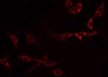 TNFRSF9 / 4-1BB / CD137 Antibody