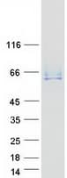 Human ANTXR2 / CMG2 Protein (Recombinant Myc-DDK (Flag))
