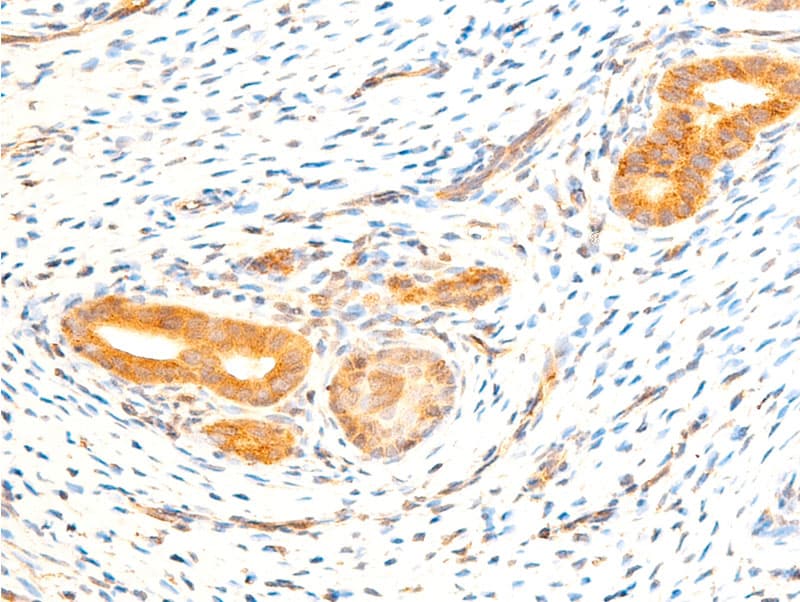 RELA / NFKB p65 Antibody (phospho-Ser536)