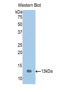 TMOD1 / Tropomodulin 1 Antibody (aa39-138)