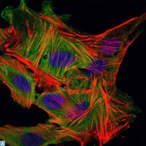 CD71 / Transferrin Receptor Antibody