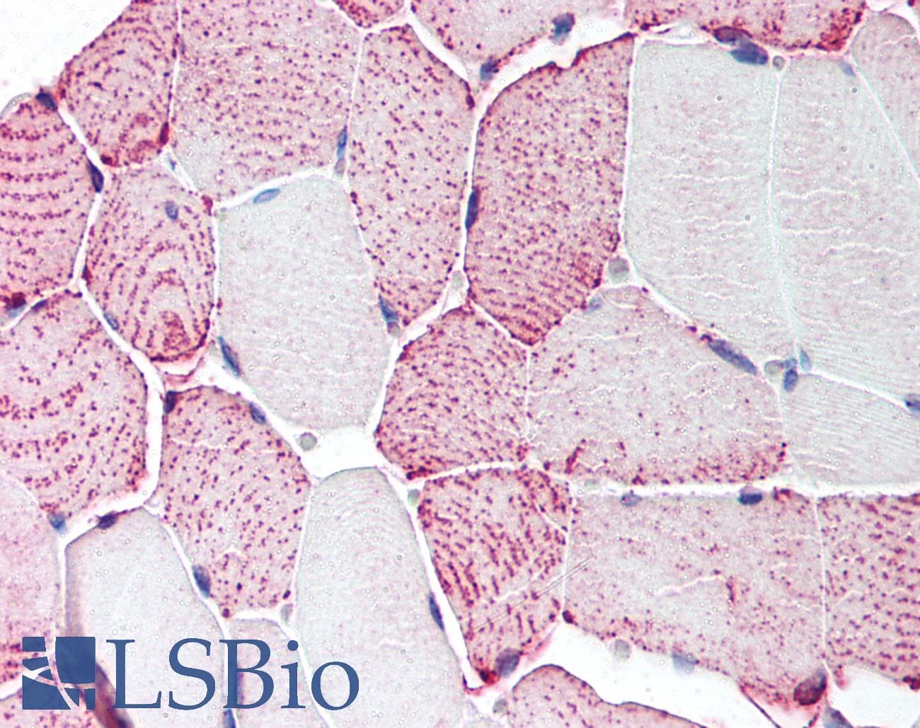 IHC-plus™ Polyclonal Rabbit anti-Human RXFP2 / LGR8 Antibody (Cytoplasmic Domain, IHC)
