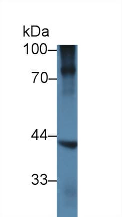 NKX6-1 Antibody (aa1-367, APC)