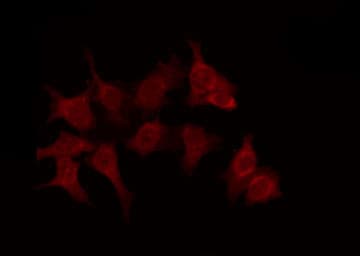 OR6C70 Antibody