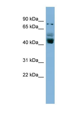ZNF620 Antibody (aa107-156)