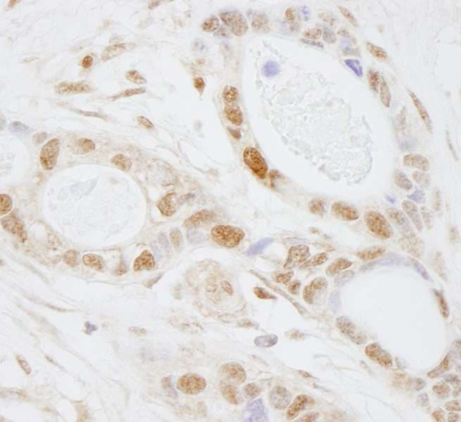 Polyclonal Rabbit anti-Human PUS1 Antibody (aa377-427, IHC)