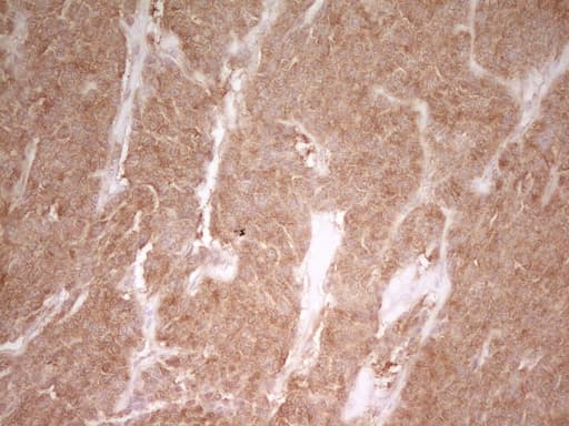 Monoclonal Mouse anti-Human PAK4 Antibody (clone OTI1C7, aa1-308, IHC, WB)