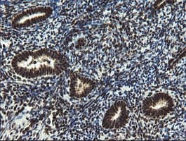 Mannose Phosphate Isomerase Antibody (clone OTI4G7)