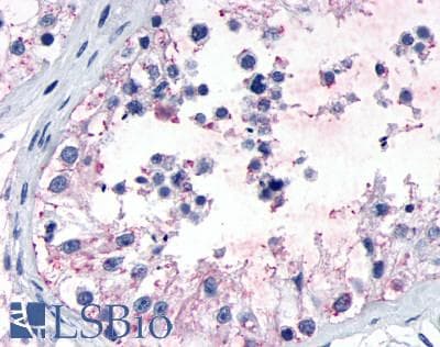 IHC-plus™ GPR149 / PGR10 Antibody (N-Terminus)