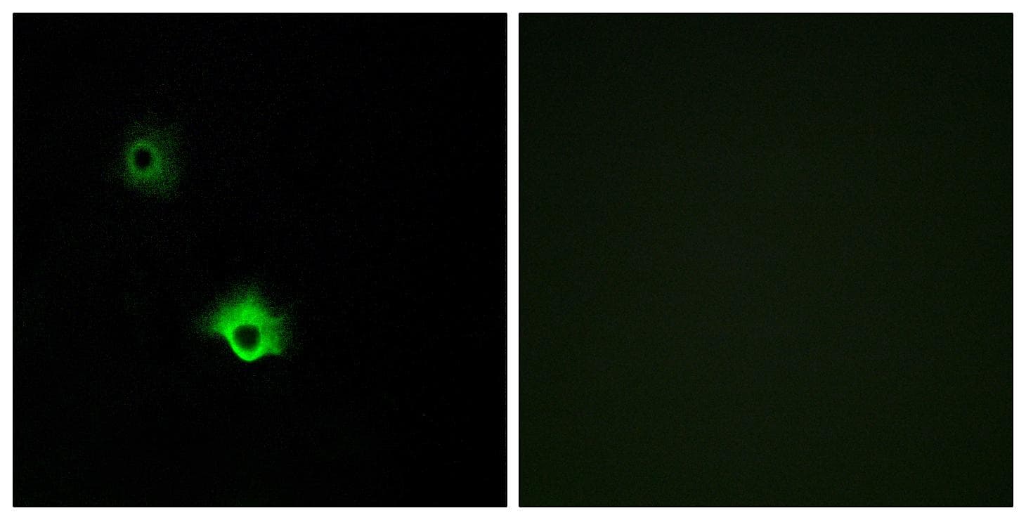 GALR3 / Galanin Receptor 3 Antibody