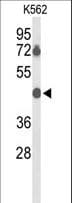 Polyclonal Rabbit anti-Human BTBD10 / GMRP-1 Antibody (aa191-218, WB)