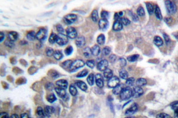 STAT2 Antibody (Leu684)