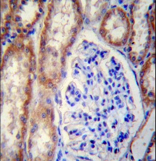 FOXO3 / FOXO3A Antibody (aa224-253)