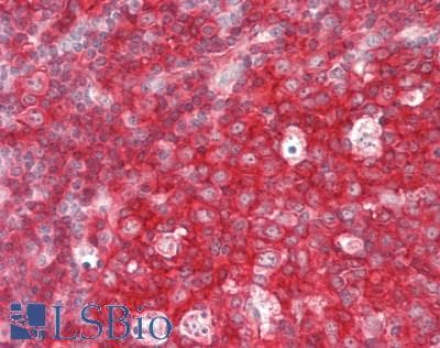 PathPlus™ CD19 Antibody (C-Terminus)