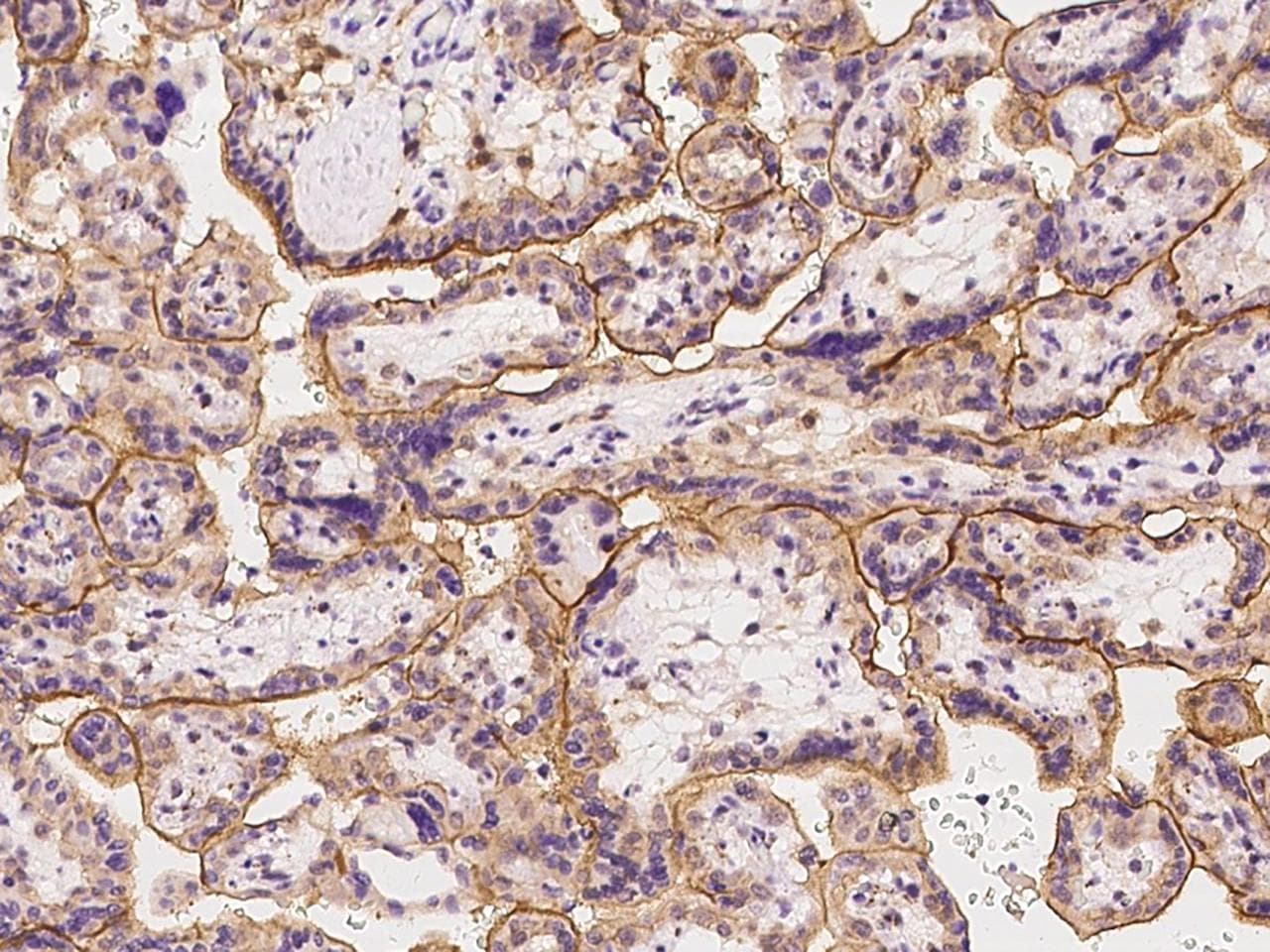 Polyclonal Rabbit anti-Human SLC19A3 Antibody (IHC)