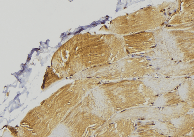PDLIM7 / Enigma Antibody