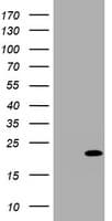 CDKN2C / p18 INK4c Antibody (clone OTI1E4)