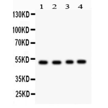 SOCS4 Antibody (aa291-440)