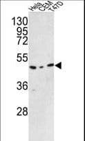 TRMO / C9orf156 Antibody (aa365-391)