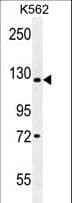 KDM4C / JMJD2C Antibody (aa1023-1056)