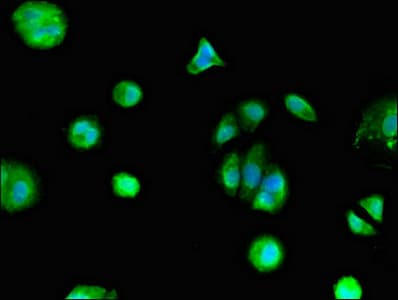 Polyclonal Rabbit anti-Human GPER1 / GPR30 Antibody (aa1-62, IHC, IF, WB)