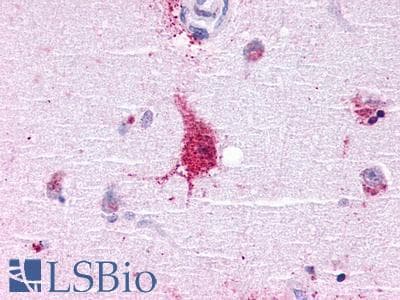 PathPlus™ LGR6 Antibody (N-terminal extracellular domain)