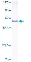 Human CDK20 / CCRK Protein (Recombinant GST)