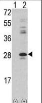 Polyclonal Rabbit anti-Human PRKCDBP / CAVIN3 Antibody (aa113-144, WB)