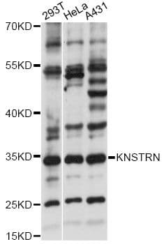 SKAP / HSD11 Antibody