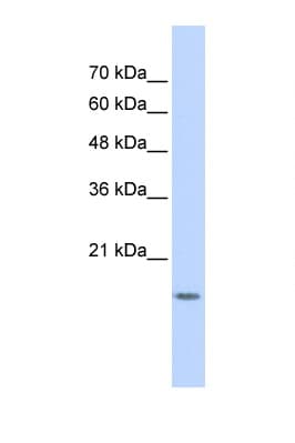 GABARAPL1 / ATG8 Antibody (aa35-84)