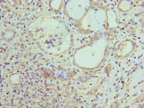 EPM2A / Laforin Antibody (aa244-331)