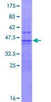 Human UBE2D2 / UBCH5B Protein (Recombinant GST)