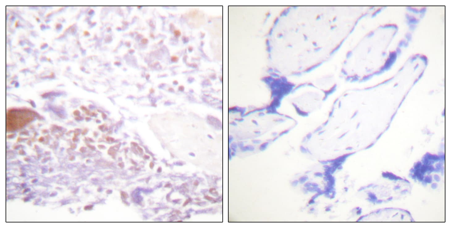 Polyclonal Rabbit anti-Human CDKN1C / p57 Kip2 Antibody (phospho-Thr310, IHC, IF, WB)