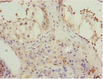 Polyclonal Rabbit anti-Human KBTBD7 Antibody (IHC)