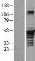 DTNBP1 / Dysbindin Protein (Over-Expression Lysate Myc-DDK (Flag))