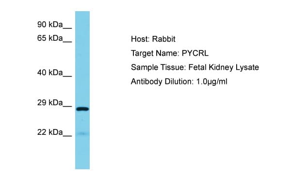 Polyclonal Rabbit anti-Human PYCRL Antibody (aa39-88, WB)