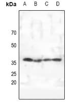 PRKAG1+2+3 Antibody
