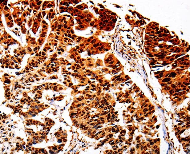 Polyclonal Rabbit anti-Human AKR1B1 / Aldose Reductase Antibody (IHC, WB)
