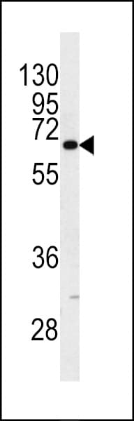 KRT9 / CK9 / Cytokeratin 9 Antibody (aa429-456)