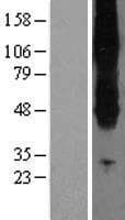 SLC43A2 Protein (Over-Expression Lysate Myc-DDK (Flag))