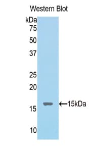 NPM1 / NPM / Nucleophosmin Antibody (aa20-154)