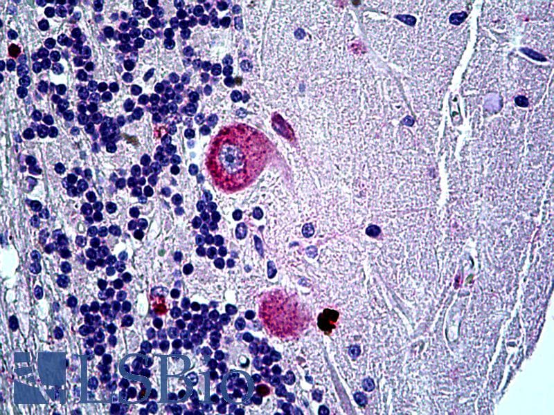 IHC-plus™ EFNA5 / Ephrin A5 Antibody (aa189-200)