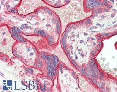 IHC-plus™ ZFYVE1 / DFCP1 Antibody