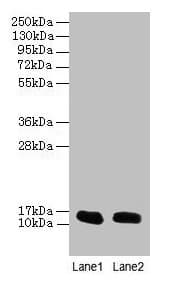 IHC-plus™ FABP1 / L-FABP Antibody (aa1-127)
