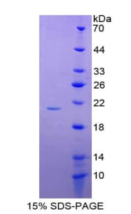 Human RELN / Reelin Protein (Recombinant His-T7)