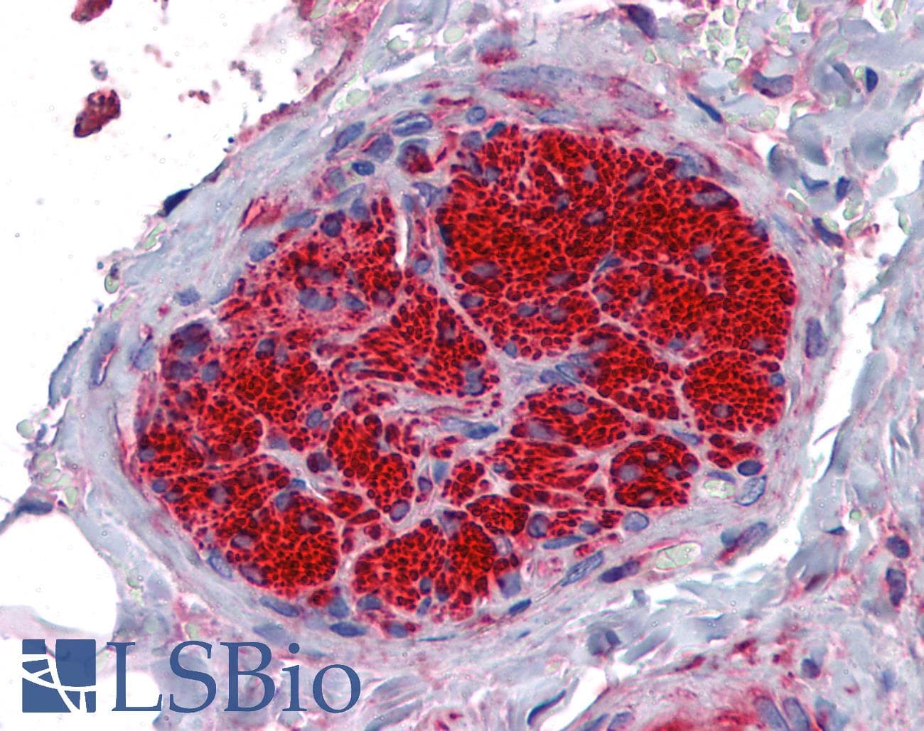 IHC-plus™ Monoclonal Mouse anti-Human SGCB / SGC / Sarcoglycan Beta Antibody (clone 1C10, IHC, IF, WB)