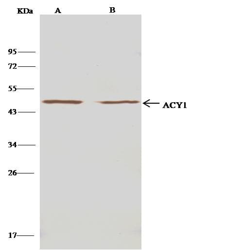 ACY1 / Aminoacylase 1 Antibody (Preservative Free)