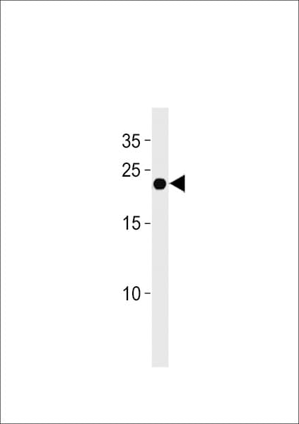 IHC-plus™ Polyclonal Rabbit anti-Human IFNA4 / Interferon Alpha 4 Antibody (aa162-189, IHC, WB)