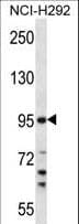 Polyclonal Rabbit anti-Human TMPRSS7 Antibody (aa103-132, WB)